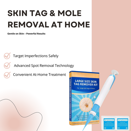 Easy Skin Tag Removal | GlowUpStudio™