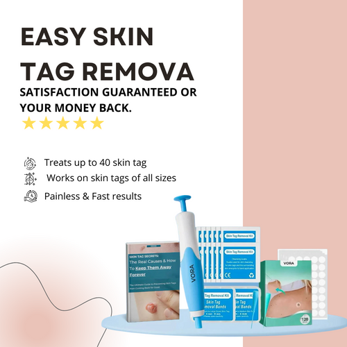 Easy Skin Tag Removal | GlowUpStudio™