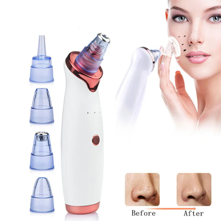 PorePerfection Pro | GlowUpStudio™